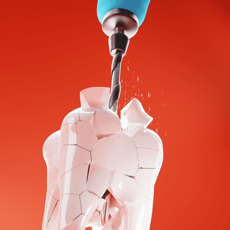 Day 35: How it really feels at the Dentist